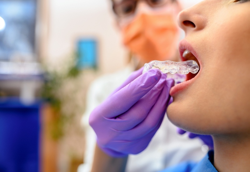 Transparent mouth guard for teeth grinding in McAllen, TX